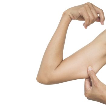 fat, arm, woman, isolated, surgery, liposuction, hand, cellulite, body, obesity, over, weight, diet, exercise, muscle, beauty, concept, medical, girl, excessive, treatment, skin, saggy, excess, underarm, lose, beautiful, care, young, female, healthy, health, slim, shape, clipping path